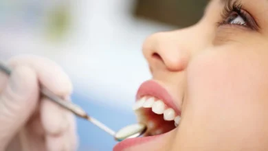 Cosmetic Dentistry